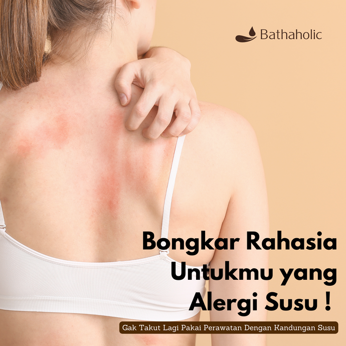 Bongkar Rahasia Untukmu yang Alergi Susu ! Gak Takut Lagi Pakai Perawatan Dengan Kandungan Susu